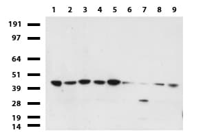 Monoclonal Mouse anti-Human PDSS2 / DLP1 Antibody (clone UMAB177, Carrier-free, IHC, WB)