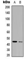 SIRT3 / Sirtuin 3 Antibody (C-Terminus)