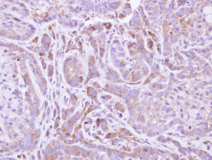 Polyclonal Rabbit anti-Human FMO2 Antibody (aa74-354, IHC, WB)