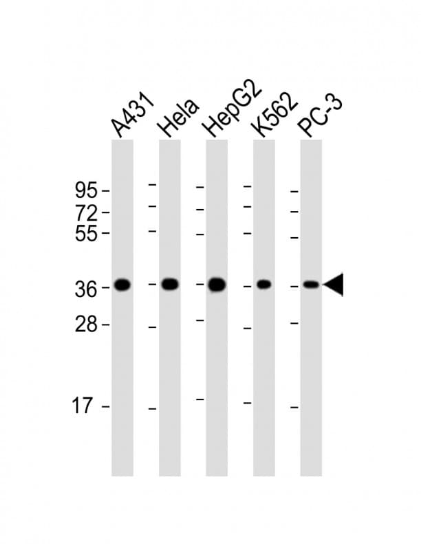 APEX1 / APE1 Antibody (clone 1518CT337.123.86.269.232)