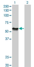 AGER / RAGE Antibody (clone 1C1)