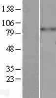 Human ITGB3 / Integrin Beta 3 / CD61 Protein (Over-Expression Lysate Myc-DDK (Flag))