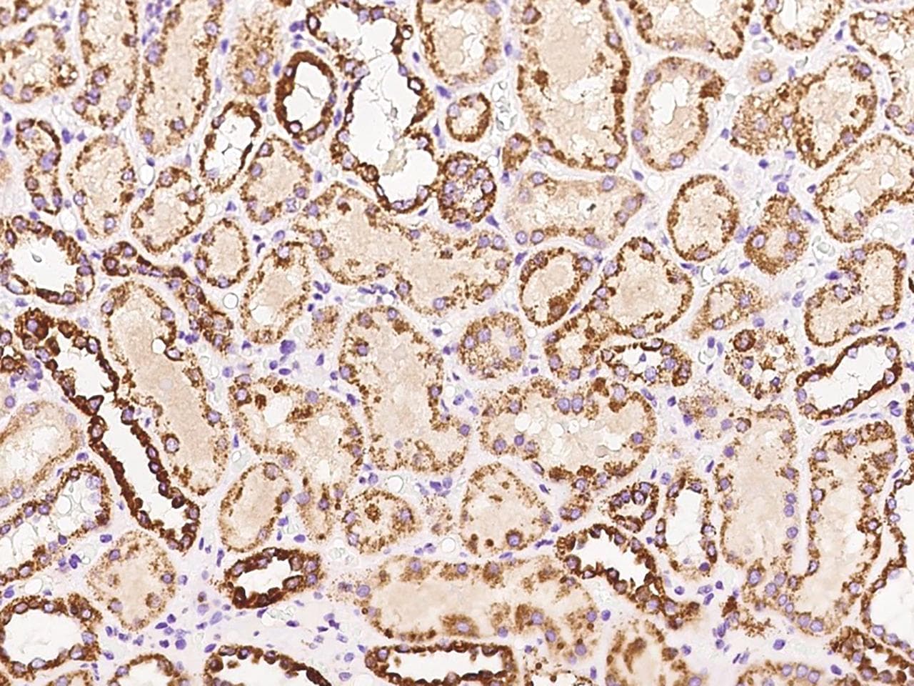 RNF128 / GRAIL Antibody