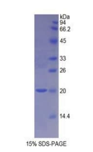 Rat NOS1 / nNOS Protein (Recombinant His)