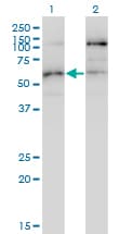 Monoclonal Mouse anti-Human STK38L / NDR2 Antibody (clone 4E5, IHC, WB)