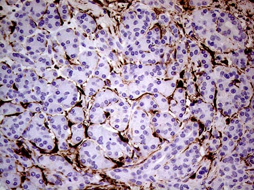 TGM2 / Transglutaminase 2 Antibody (clone OTI1C4, Carrier-free)