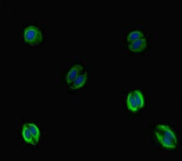 Polyclonal Rabbit anti-Human VTN / Vitronectin Antibody (IHC, IF, WB)