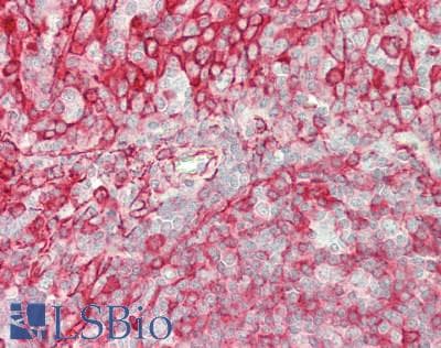 Polyclonal Rabbit anti-Human SLC26A1 Antibody (C-Terminus, IHC, WB)