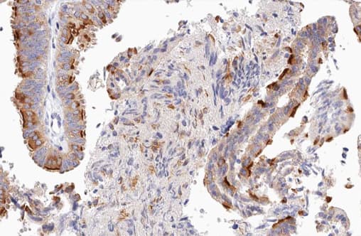 Polyclonal Rabbit anti-Human UBXN11 / SOC Antibody (IHC, IF, WB)