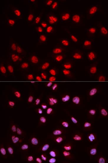 ELK1 Antibody (phospho-Ser383)