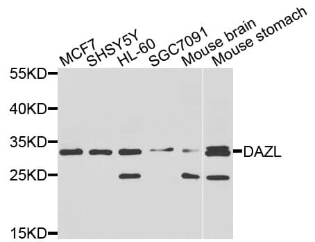 Polyclonal Rabbit anti-Human DAZL Antibody (WB)