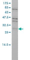 IHC-plus™ PRPK / TP53RK Antibody (clone 4B9-1H3)
