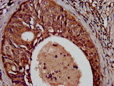 Polyclonal Rabbit anti-Human SCN11A / Nav1.9 Antibody (IHC, IF)
