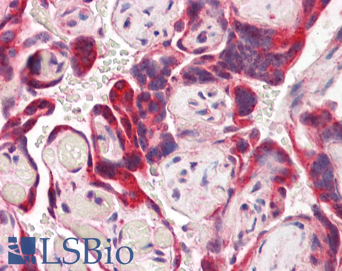 IHC-plus™ Polyclonal Goat anti-Human IDS / Iduronate 2 Sulfatase Antibody (aa440-451, IHC, WB)