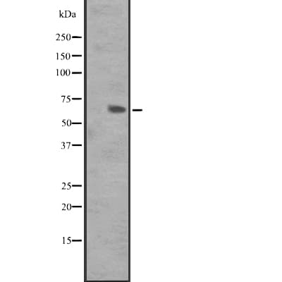 Polyclonal Rabbit anti-Human GPR162 Antibody (WB)