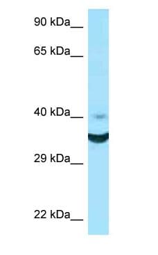 Polyclonal Rabbit anti-Human NCR1 / NKP46 Antibody (aa55-104, WB)