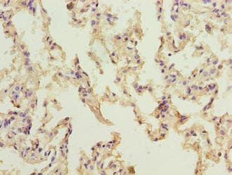 NINJ2 / Ninjurin 2 Antibody
