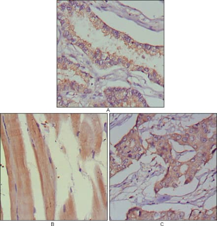 MUSK Antibody (clone 10A4)