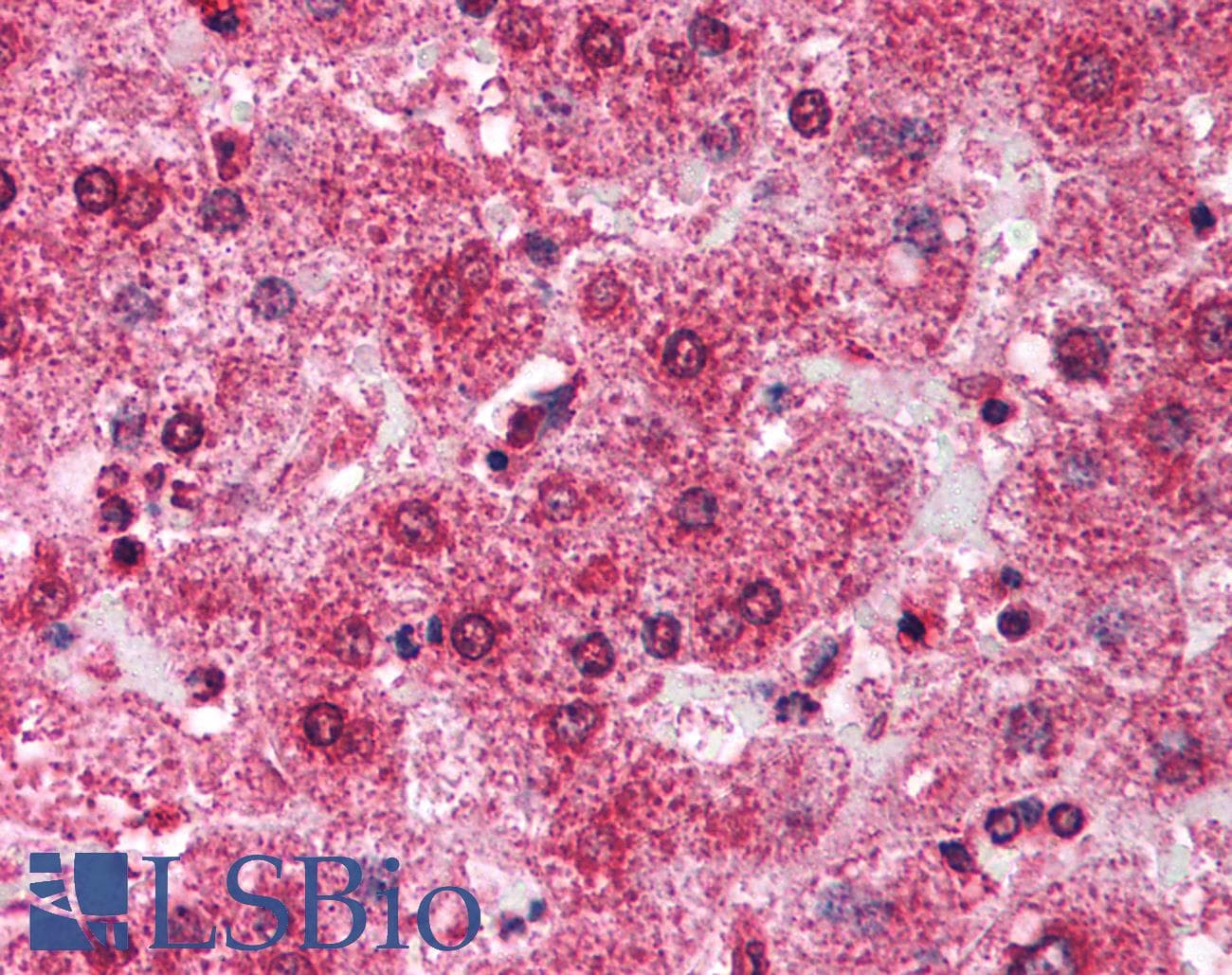Polyclonal Rabbit anti-Human TRIM14 Antibody (aa116-165, IHC, WB)