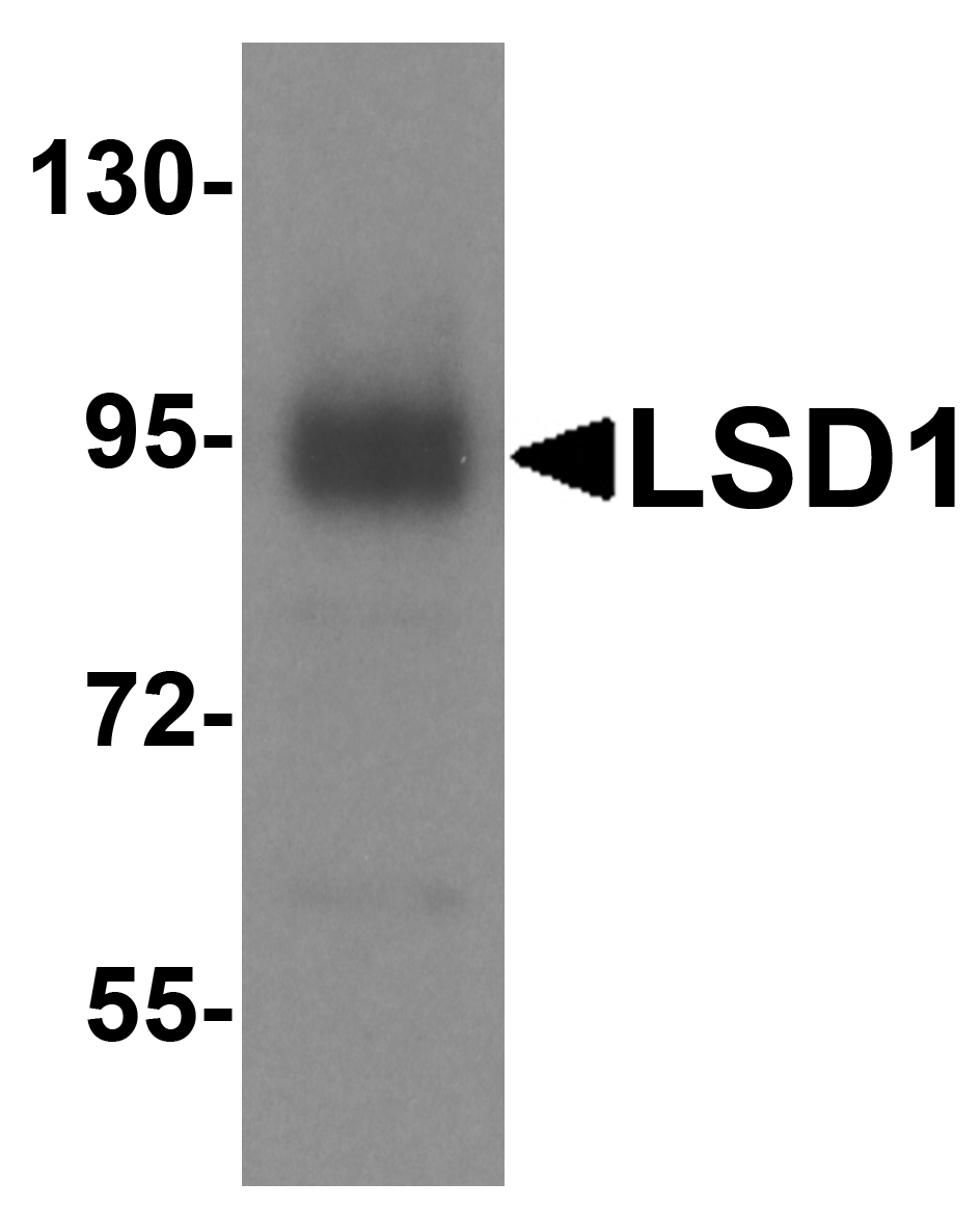 Polyclonal Rabbit anti-Human KDM1A / LSD1 Antibody (IHC, WB)
