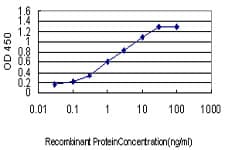MCC Antibody (clone 1A7)