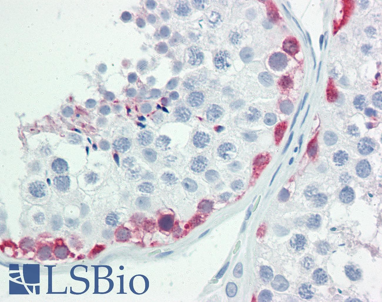 IHC-plus™ OVOL1 Antibody (aa1-50)