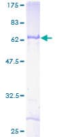 Human ABHD1 Protein (Recombinant GST)