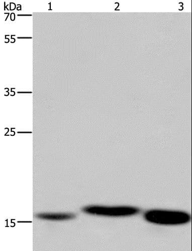 CYB5A / Cytochrome b5 Antibody