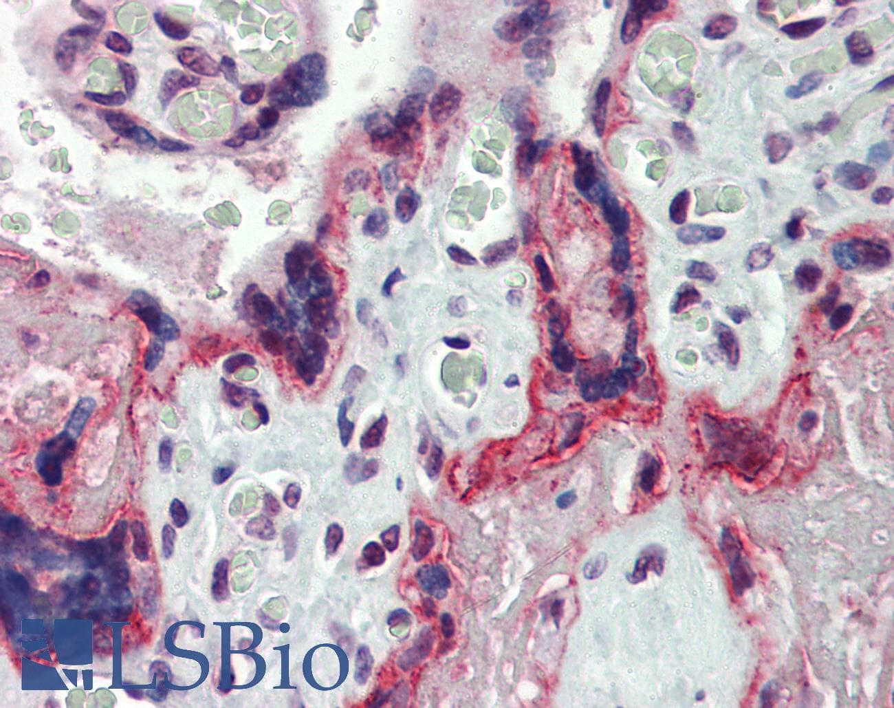 IHC-plus™ MMP3 Antibody