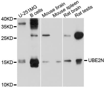 UBE2N / UBC13 Antibody