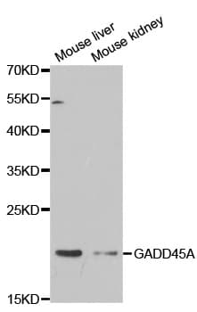 IHC-plus™ GADD45A / GADD45 Antibody