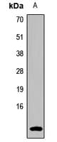 GUCA2B / Uroguanylin Antibody