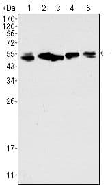 KRT8 / CK8 / Cytokeratin 8 Antibody (aa391-483, clone 8A5D12)