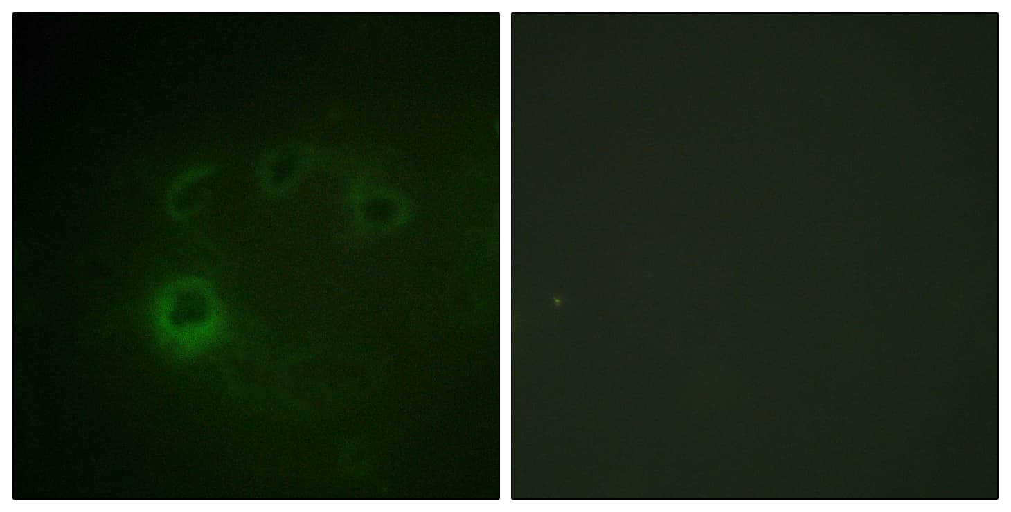 RPS6KB1 / P70S6K / S6K Antibody (phospho-Ser418)