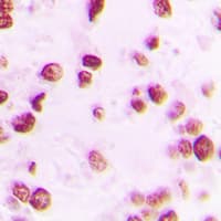 DCLRE1C / Artemis Antibody (phospho-Ser516)