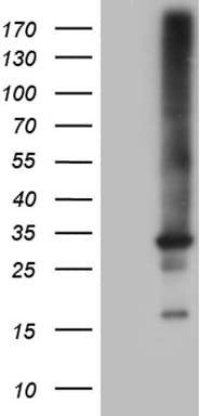 RAB23 Antibody (aa1-234, clone OTI4C7)