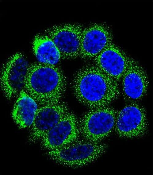 IHC-plus™ Polyclonal Rabbit anti-Human CYP21A2 Antibody (aa216-246, IHC, IF, WB)
