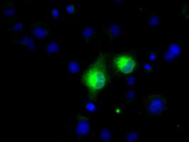 MSMB / MSP Antibody (clone OTI6C7, Carrier-free)
