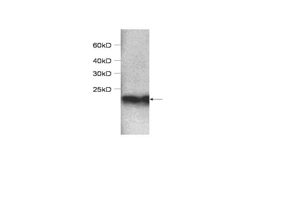 IHC-plus™ SOD1 / Cu-Zn SOD Antibody
