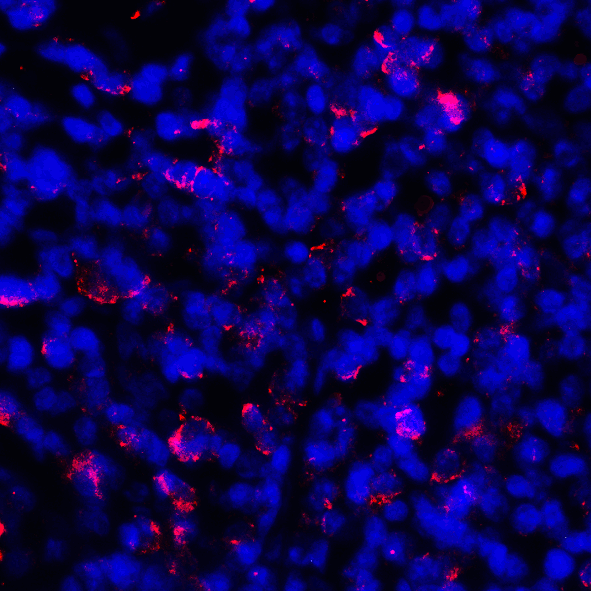 CD274 / B7-H1 / PD-L1 Antibody (clone 6H10)