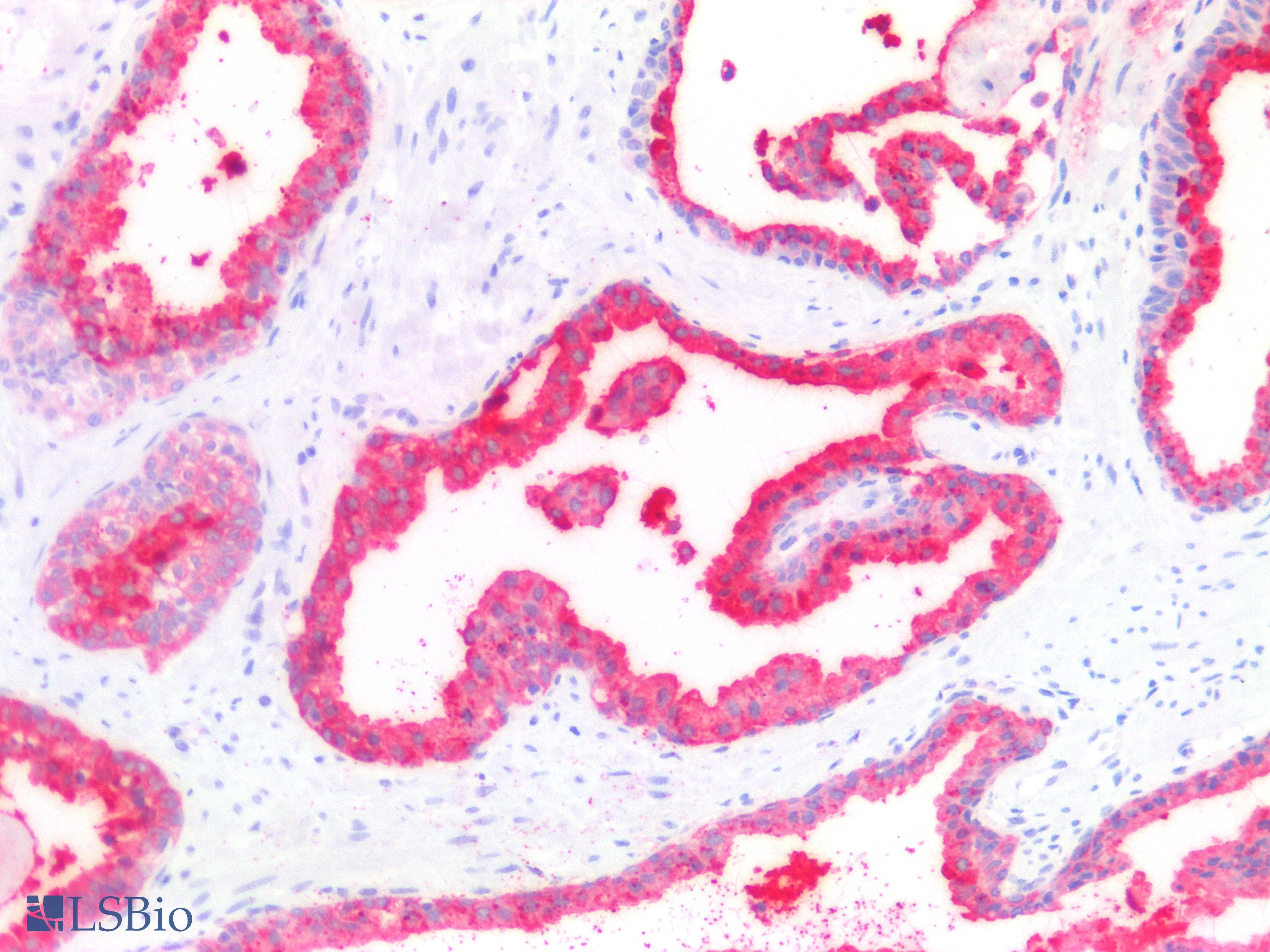 PathPlus™ ACPP / PAP Antibody