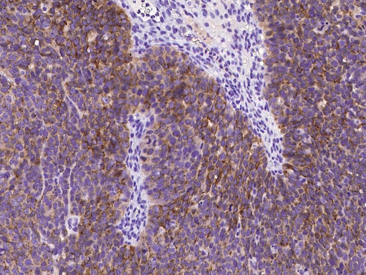 Monoclonal Mouse anti-Human MSLN / Mesothelin Antibody (clone 01, Preservative Free, IHC)