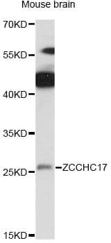 ZCCHC17 / PNO40 / PS1D Antibody
