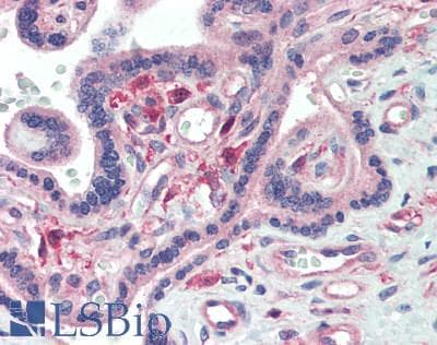 IHC-plus™ IL-22BP / IL22RA2 Antibody