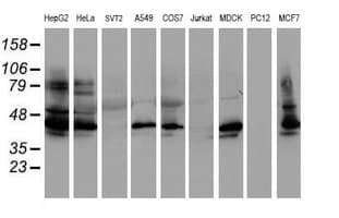 SERPINB1 Antibody (aa77-306, clone OTI1D1, Carrier-free)