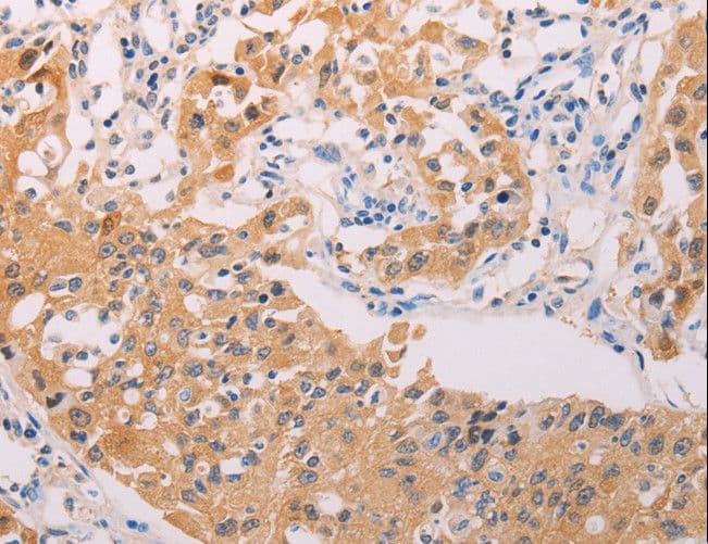 ADHFE1 Antibody