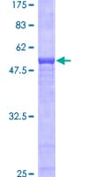 Human AZGP1 / ZAG Protein (Recombinant GST)