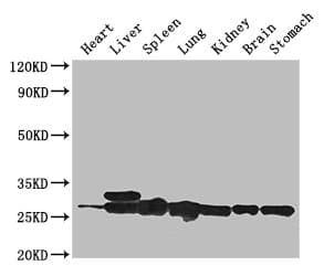Polyclonal Rabbit anti-Human SWI5 / C9orf119 Antibody (IHC, WB)