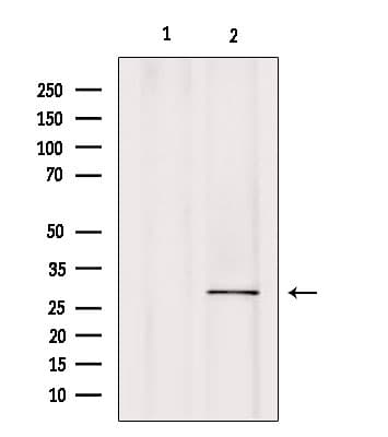 CA7 / Carbonic Anhydrase VII Antibody