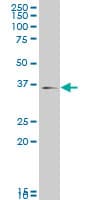 MAPK14 / p38 Antibody (clone 3D5)
